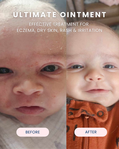 Noodle & Boo | Ultimate Ointment, 10 oz.