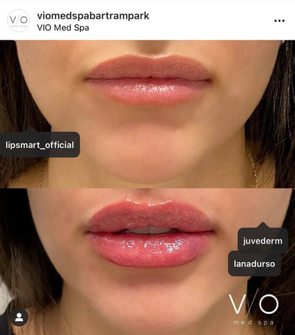 Lipsmart Hydrating Treatment Samples 25ct