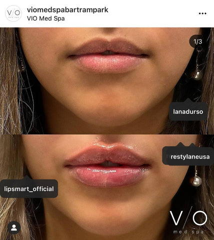 Lipsmart Hydrating Treatment Samples 25ct